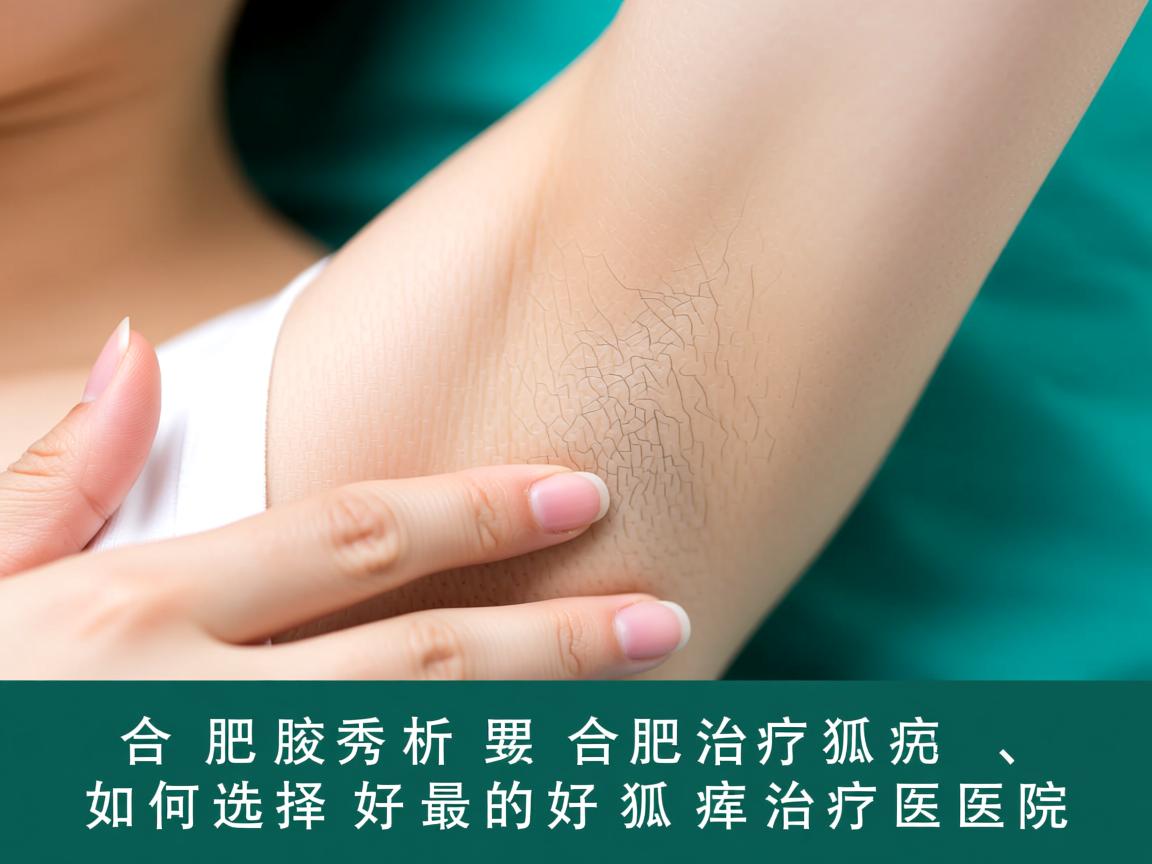 合肥腋秀解析，在合肥治疗狐臭，如何选择最好的狐臭治疗医院
