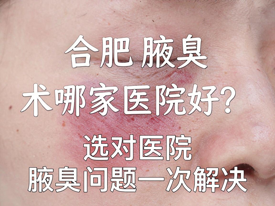 合肥腋臭微创手术哪家医院好？选对医院，腋臭问题一次解决