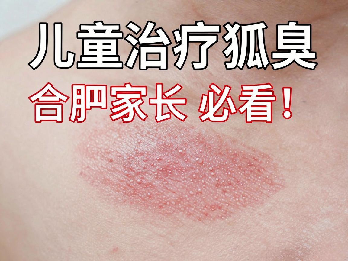 儿童治疗狐臭，合肥家长必看！儿童狐臭治疗，这些方法更靠谱