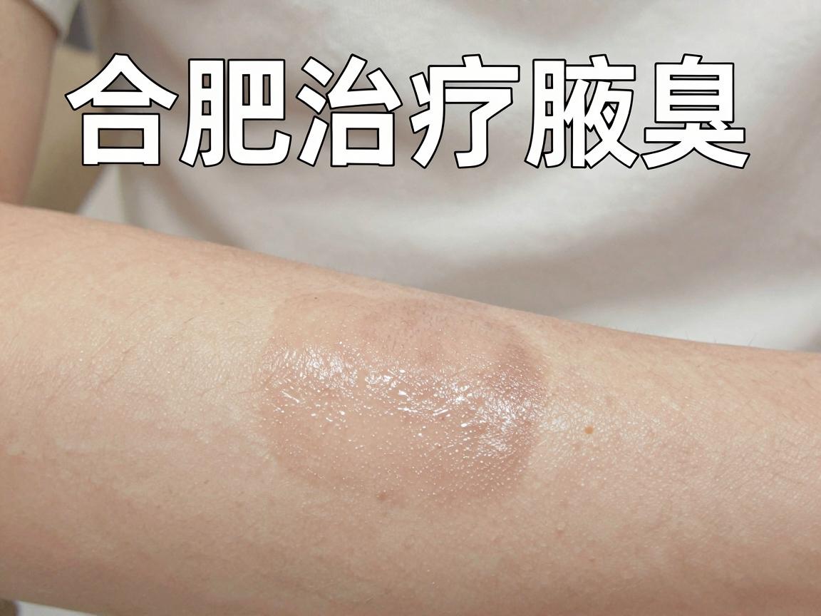 合肥治疗腋臭医院哪家比较好？这家医院的治疗方案值得一看