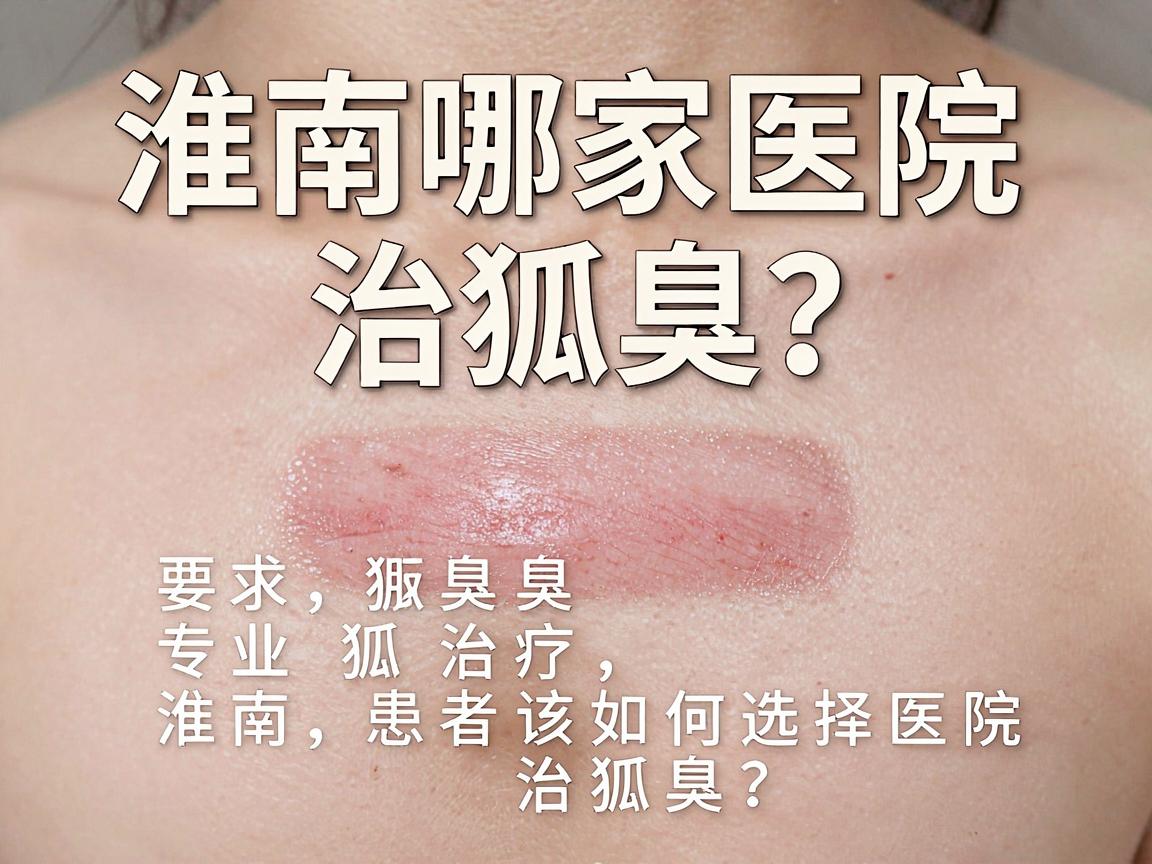 淮南哪家医院治狐臭？专业解读狐臭治疗，淮南患者该如何选择医院治狐臭？