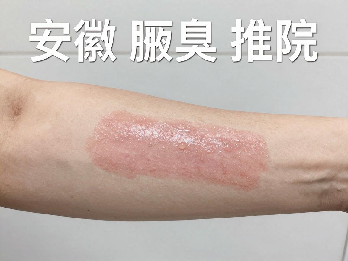 安徽腋臭医院推荐，专业腋臭治疗，告别腋臭尴尬