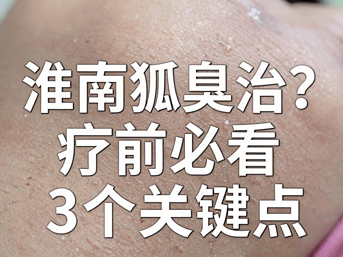 淮南狐臭医院怎么选?淮南狐臭治疗前必看的3个关键点 淮南狐臭医院怎么选?淮南狐臭治疗前必看的3个关键点