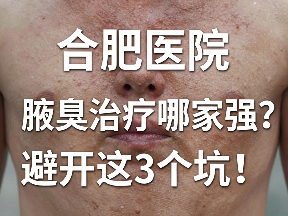合肥腋臭治疗哪家好？深度解析合肥医院腋臭治疗哪家强，避开这3个坑！
