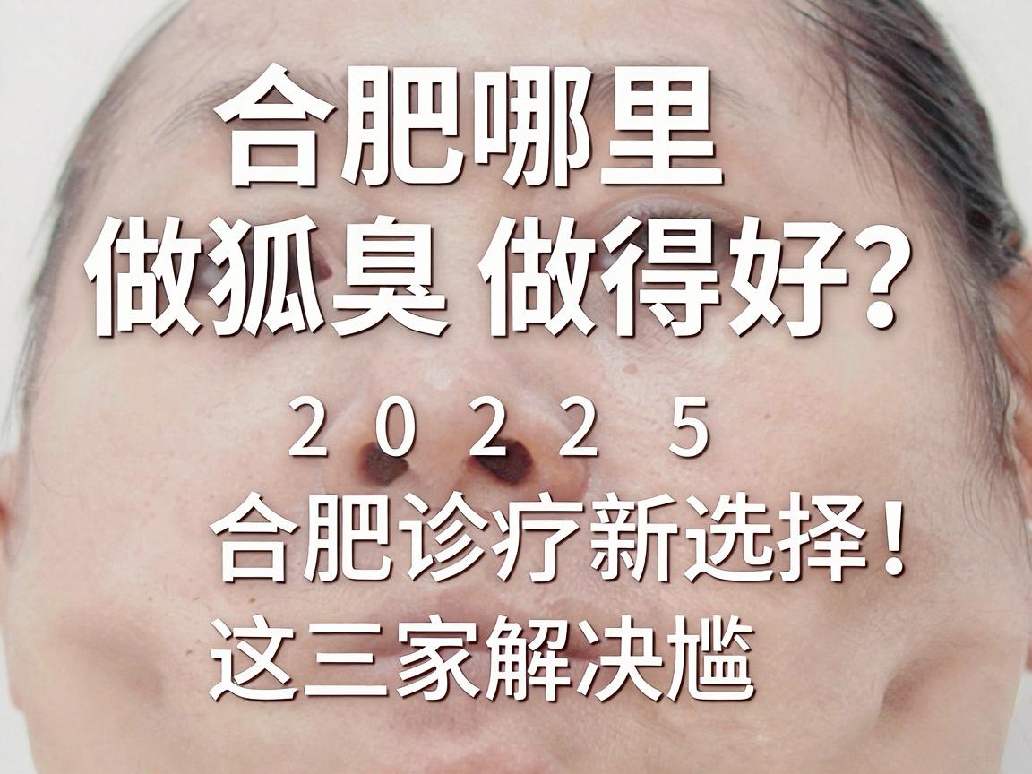 合肥哪里做狐臭做得好?2025年合肥腋臭诊疗新选择,这三家帮您解决尴尬 合肥哪里做狐臭做得好?2025年合肥腋臭诊疗新选择,这三家帮您解决尴尬