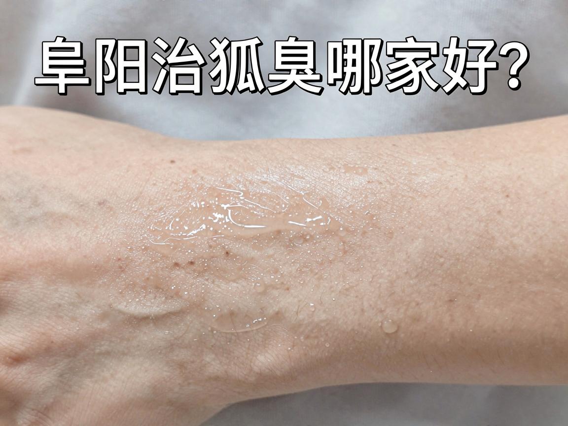 阜阳治狐臭哪家好？专业医生告诉你，阜阳治疗狐臭选对方法才叫好