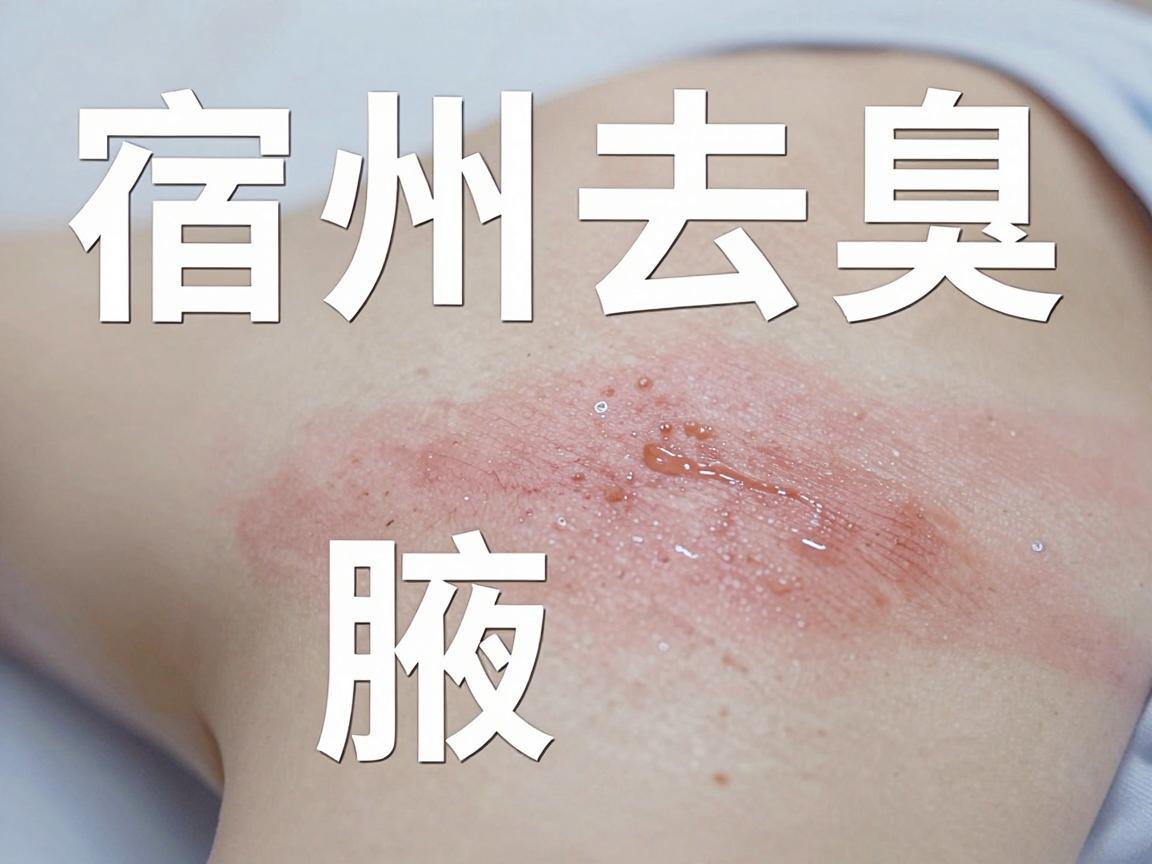 宿州去腋臭，哪个医院更靠谱？从专业角度帮你分析哪个医院的选择逻辑