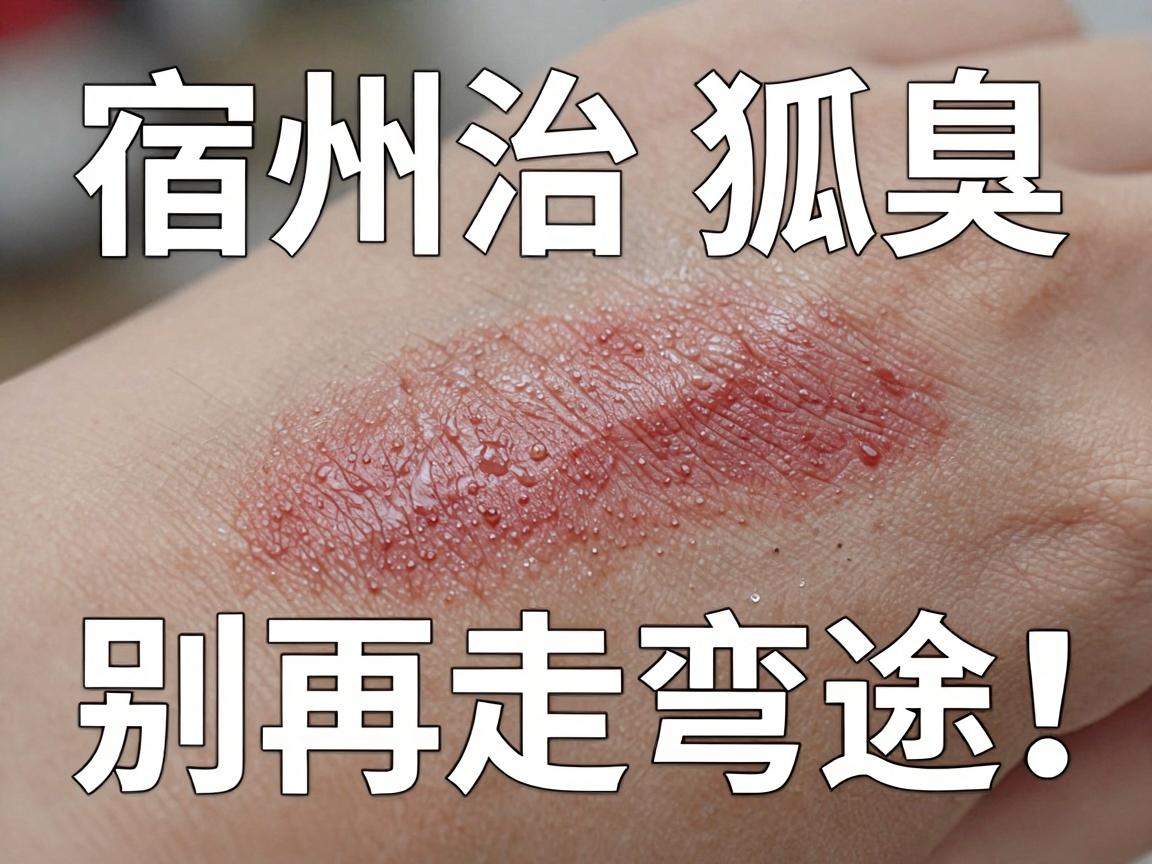 宿州治狐臭，别再走弯路！宿州正规医院该如何选？