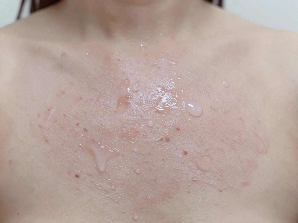 六安治疗腋臭的医院怎么选？六安腋臭治疗别走弯路