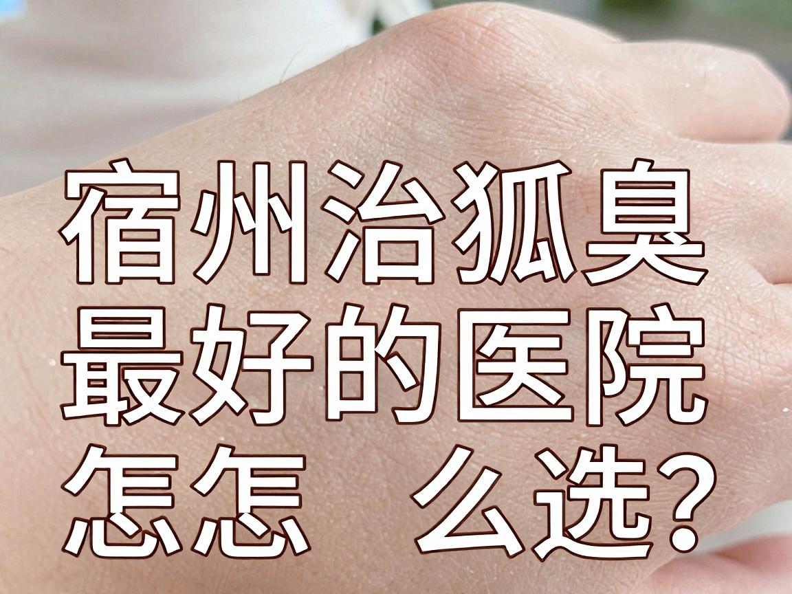 宿州治狐臭最好的医院怎么选？治狐臭的医院关键看这三点