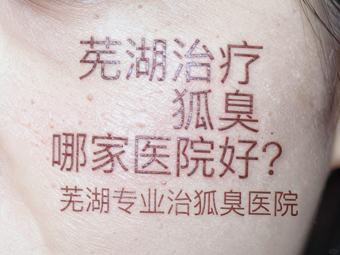 芜湖治疗狐臭哪家医院好？深度测评芜湖专业治狐臭医院