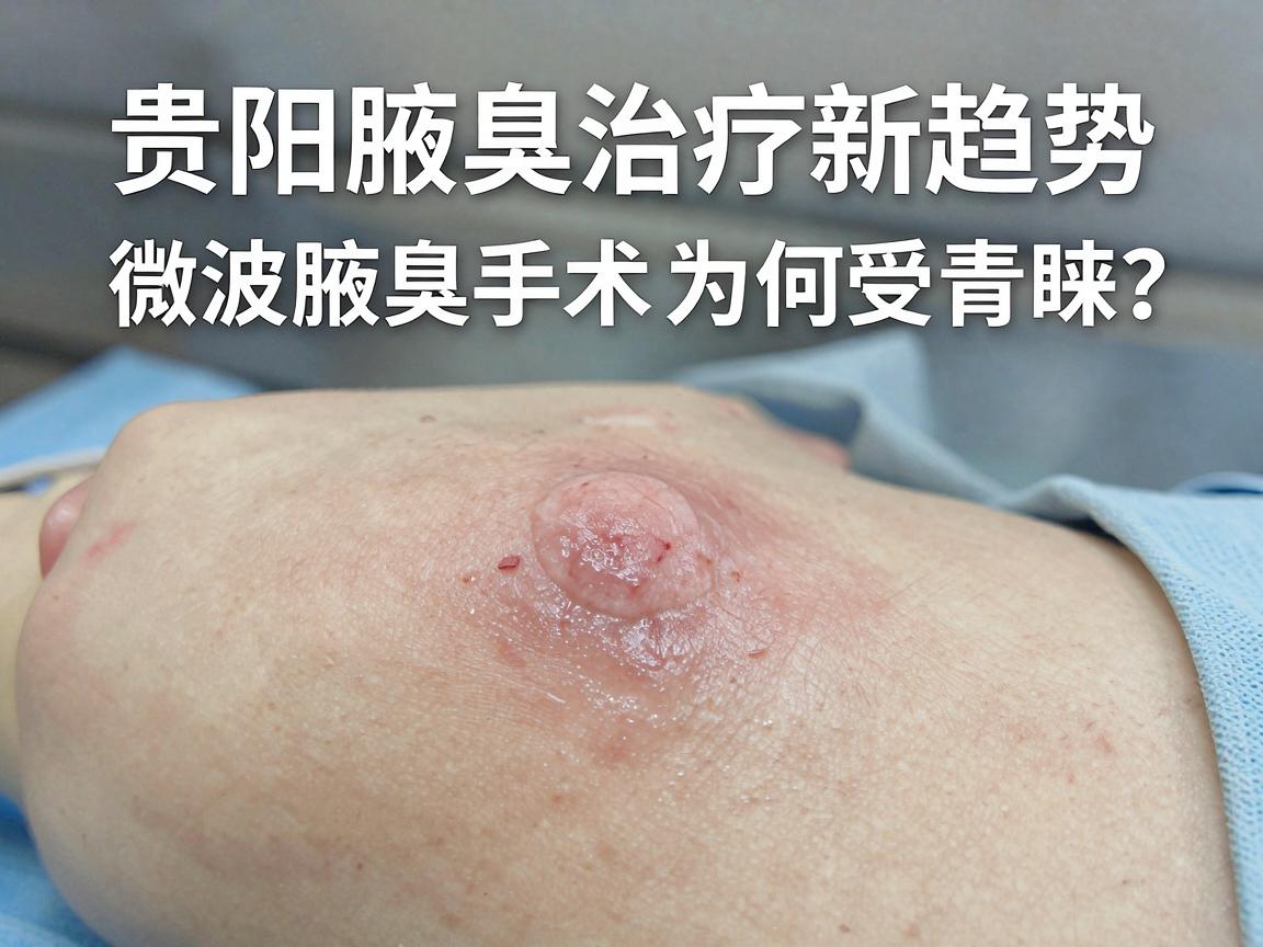 微波腋臭手术，贵阳腋臭治疗新趋势，微波腋臭手术为何受青睐？