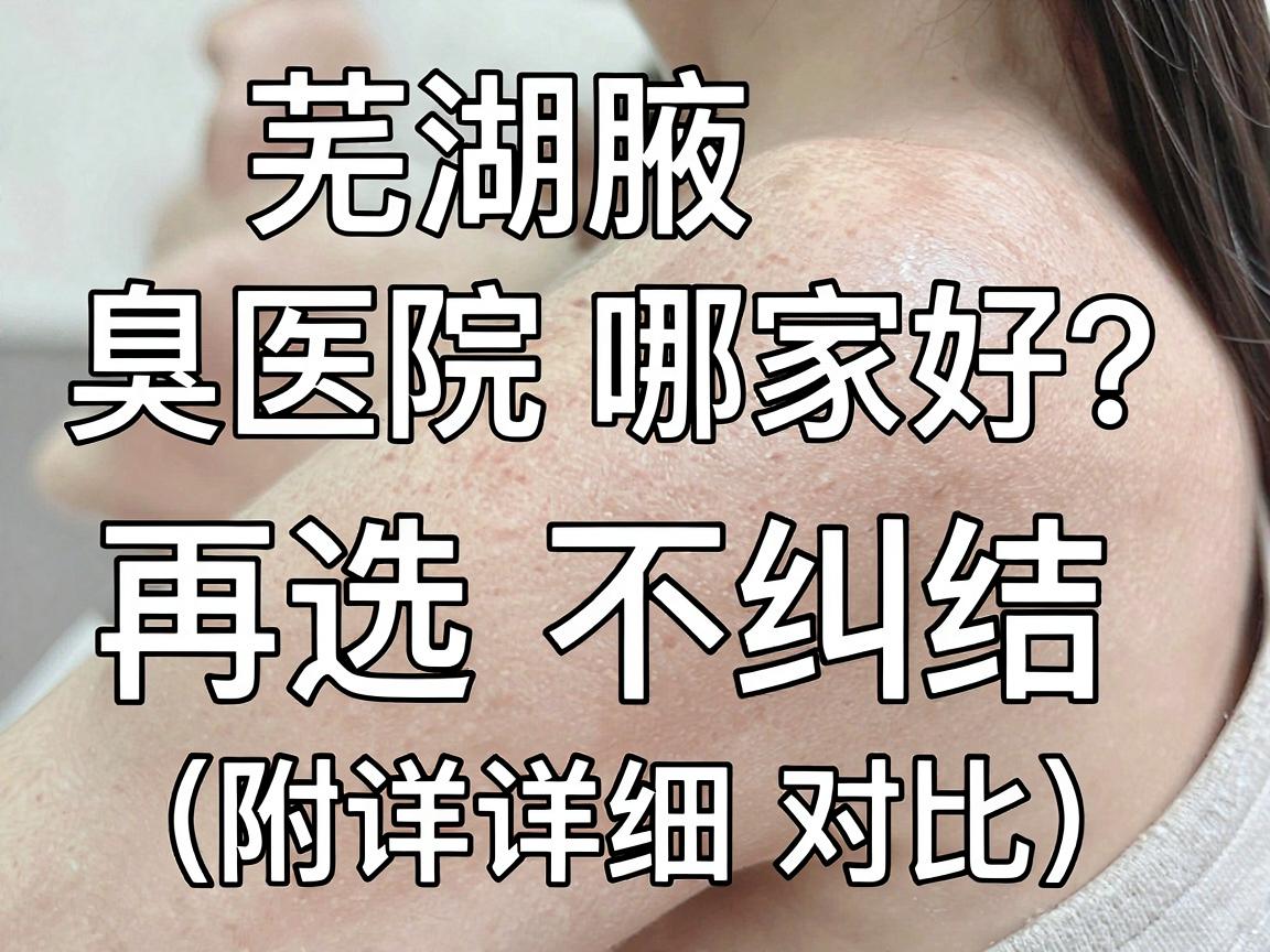 芜湖腋臭医院哪家好？看完这篇再选不纠结（附详细对比）