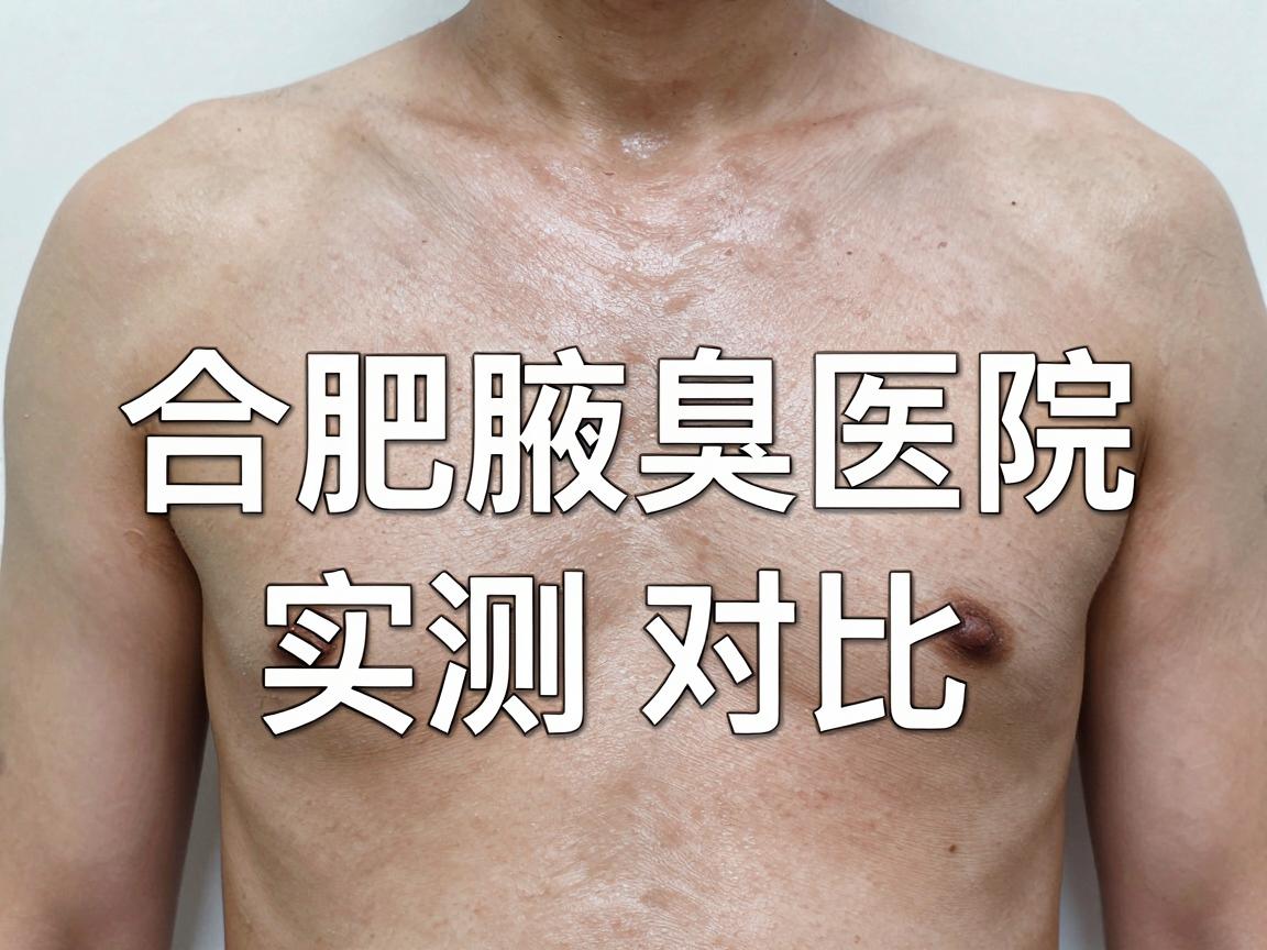 合肥腋下异味医院怎么选？合肥腋臭医院实测对比指南