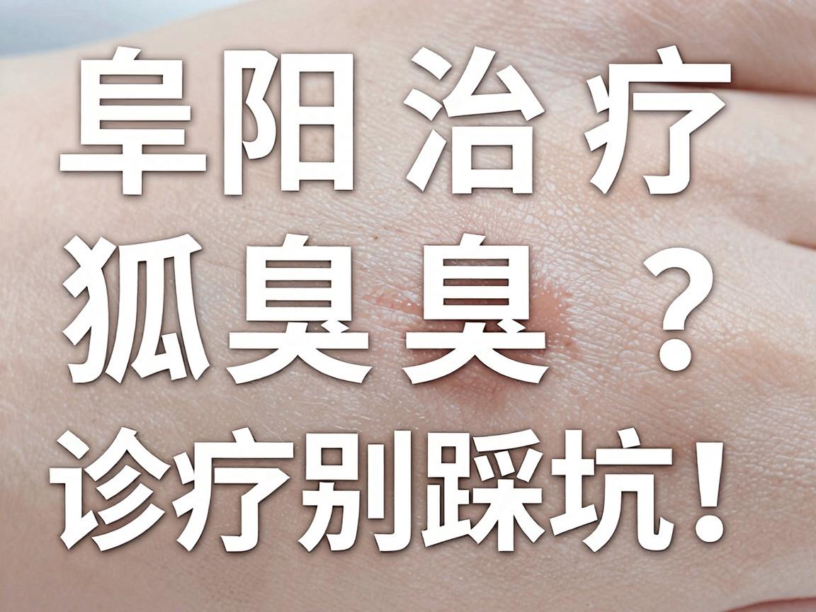 阜阳治疗狐臭去哪家医院？阜阳腋臭诊疗别踩坑！