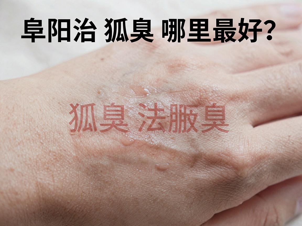 阜阳治狐臭哪里最好？阜阳狐臭治疗选对方法才最好