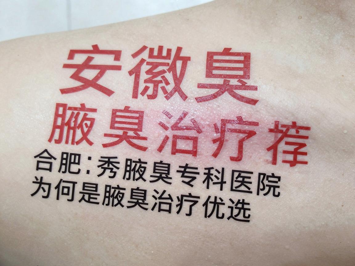 安徽腋臭治疗医院推荐，合肥腋秀腋臭专科医院为何是腋臭治疗优选