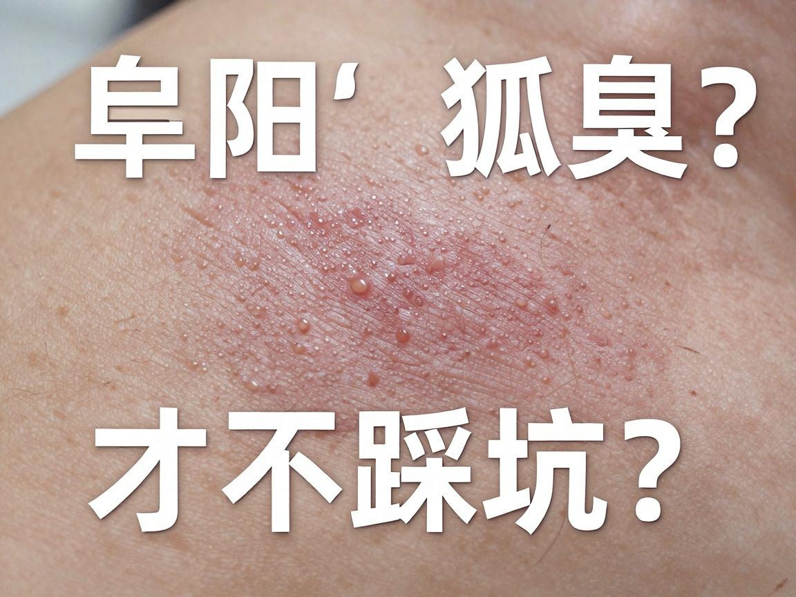 阜阳狐臭微创手术哪家好？阜阳狐臭微创术怎么选才不踩坑？