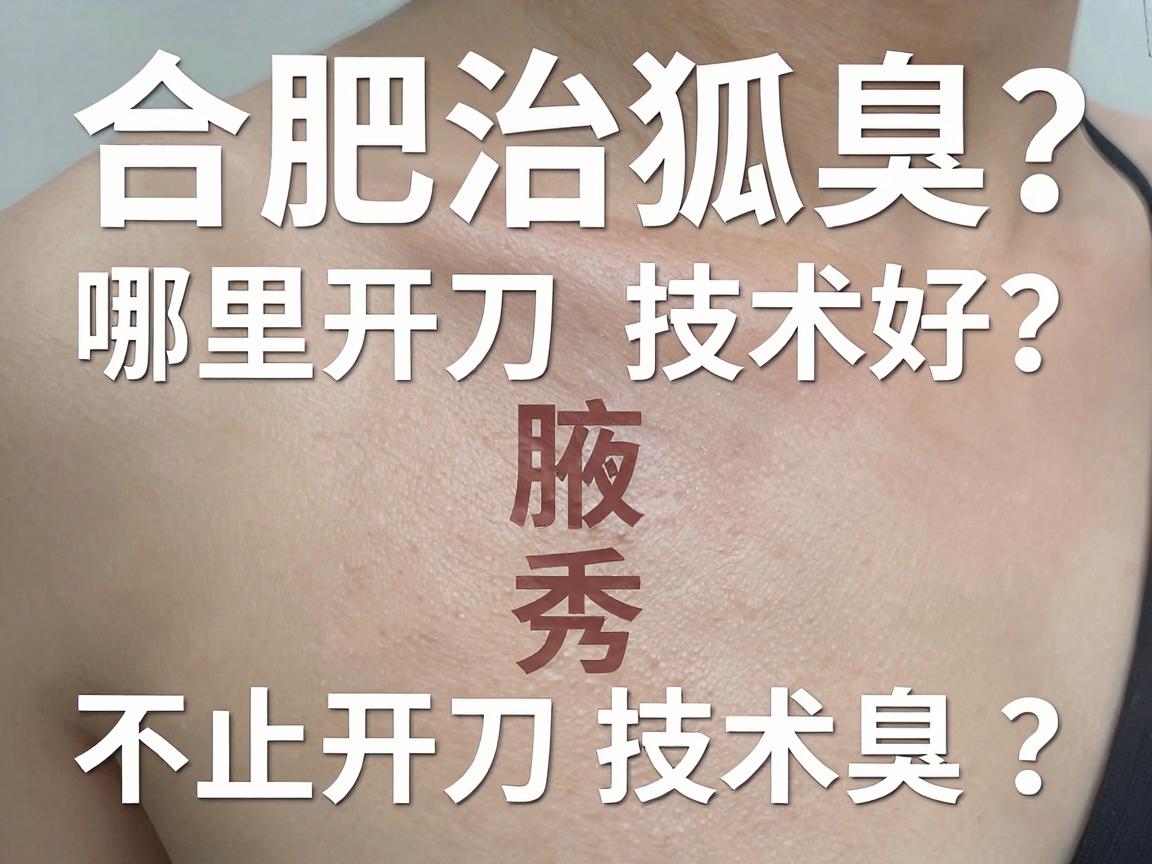 合肥治狐臭，哪里开刀技术好？合肥腋秀，专业祛臭，不止是开刀