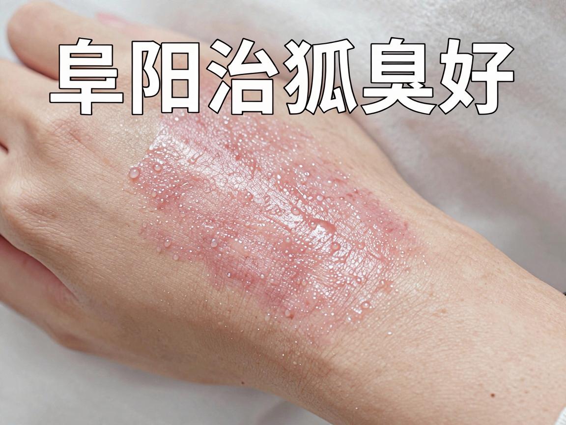 阜阳治狐臭好的医院怎么选？阜阳治狐臭的医院攻略来了