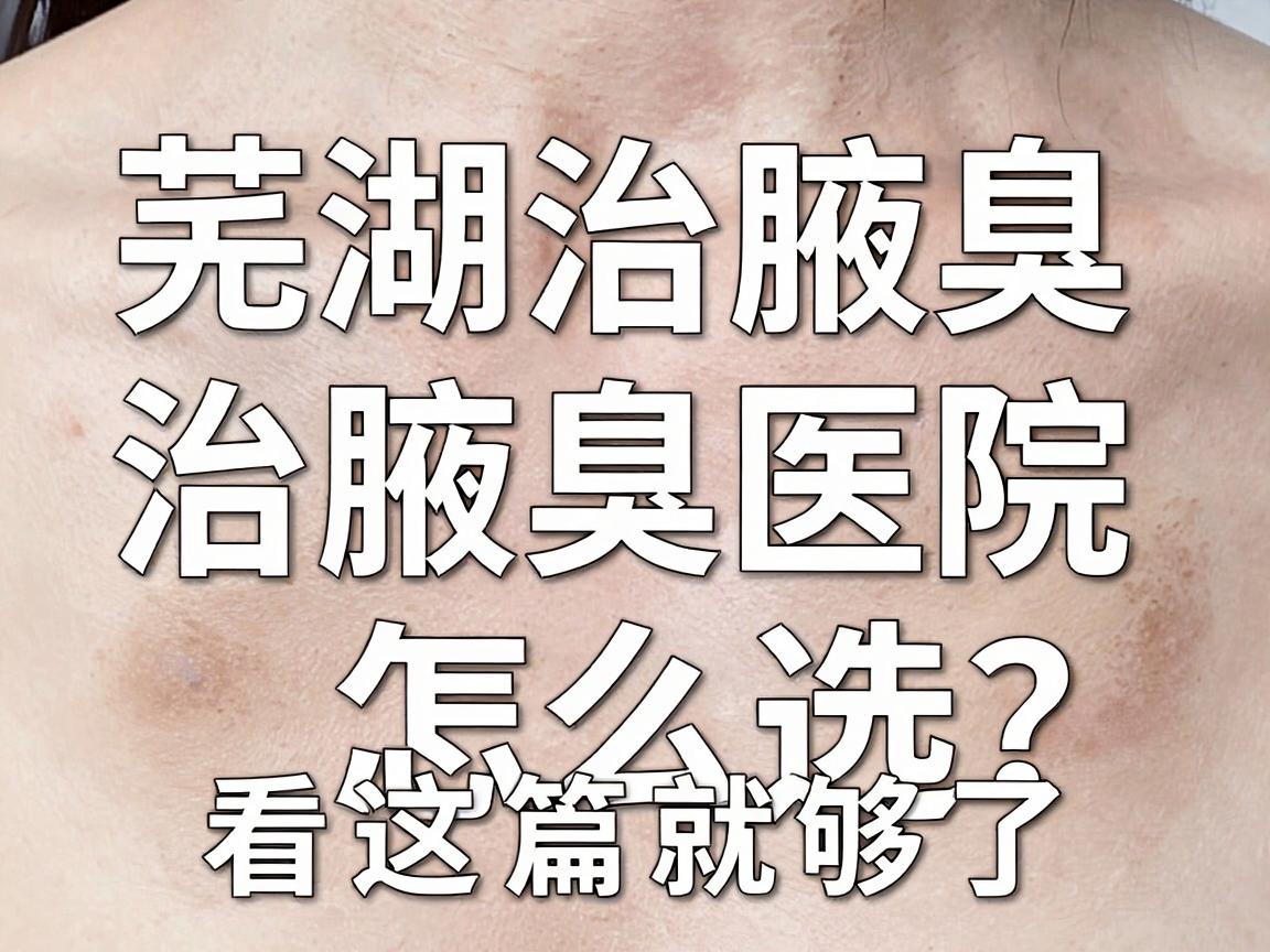 芜湖治腋臭，治腋臭医院怎么选？看这篇就够了