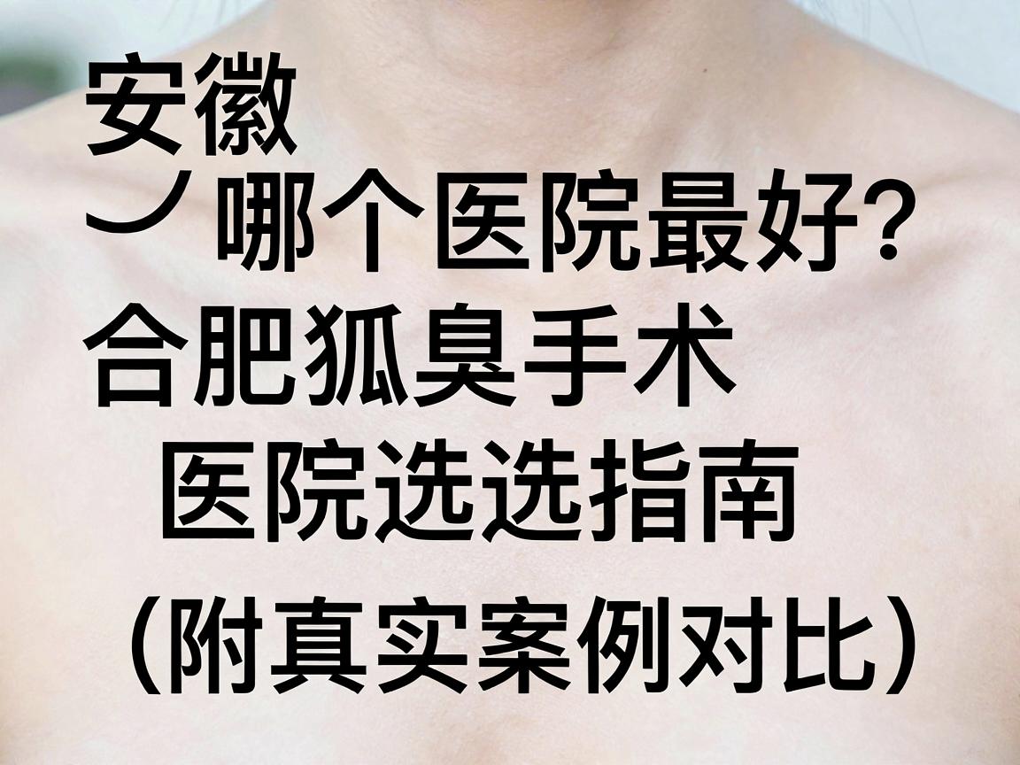 安徽狐臭手术哪个医院最好？合肥狐臭手术医院选择指南（附真实案例对比）