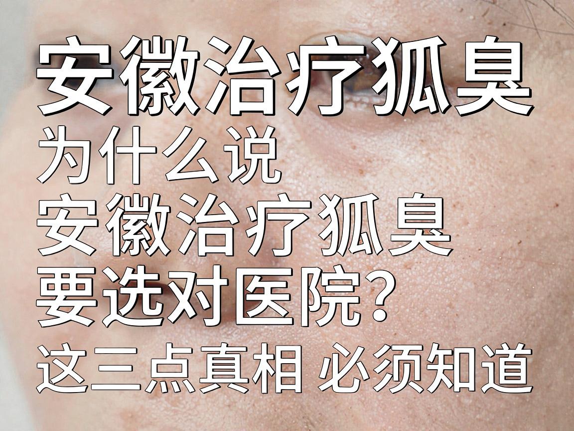 安徽治疗狐臭,为什么说安徽治疗狐臭要选对医院?这三点真相必须知道 安徽治疗狐臭,为什么说安徽治疗狐臭要选对医院?这三点真相必须知道