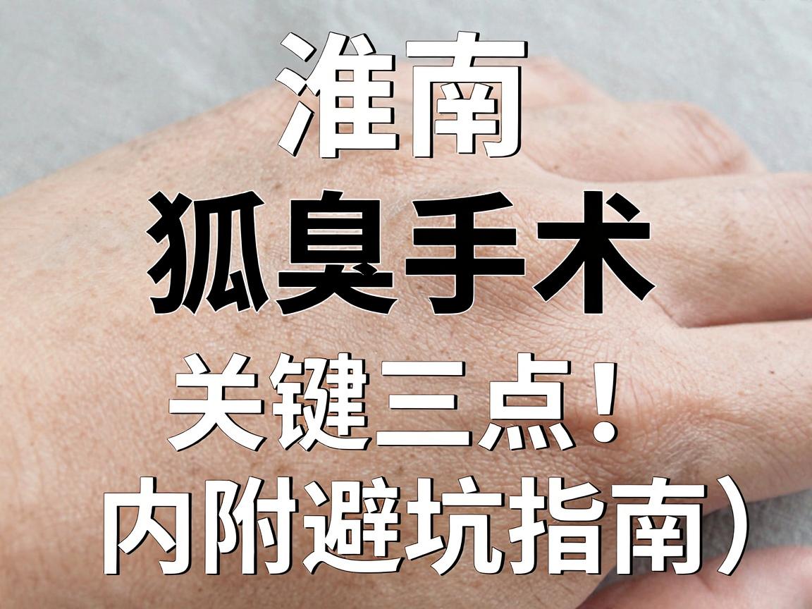 淮南狐臭手术去哪家？狐臭手术医院选择关键看三点！内附避坑指南）