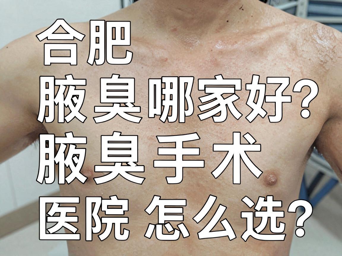 合肥腋臭医院哪家好？腋臭手术医院怎么选？这份攻略请收好