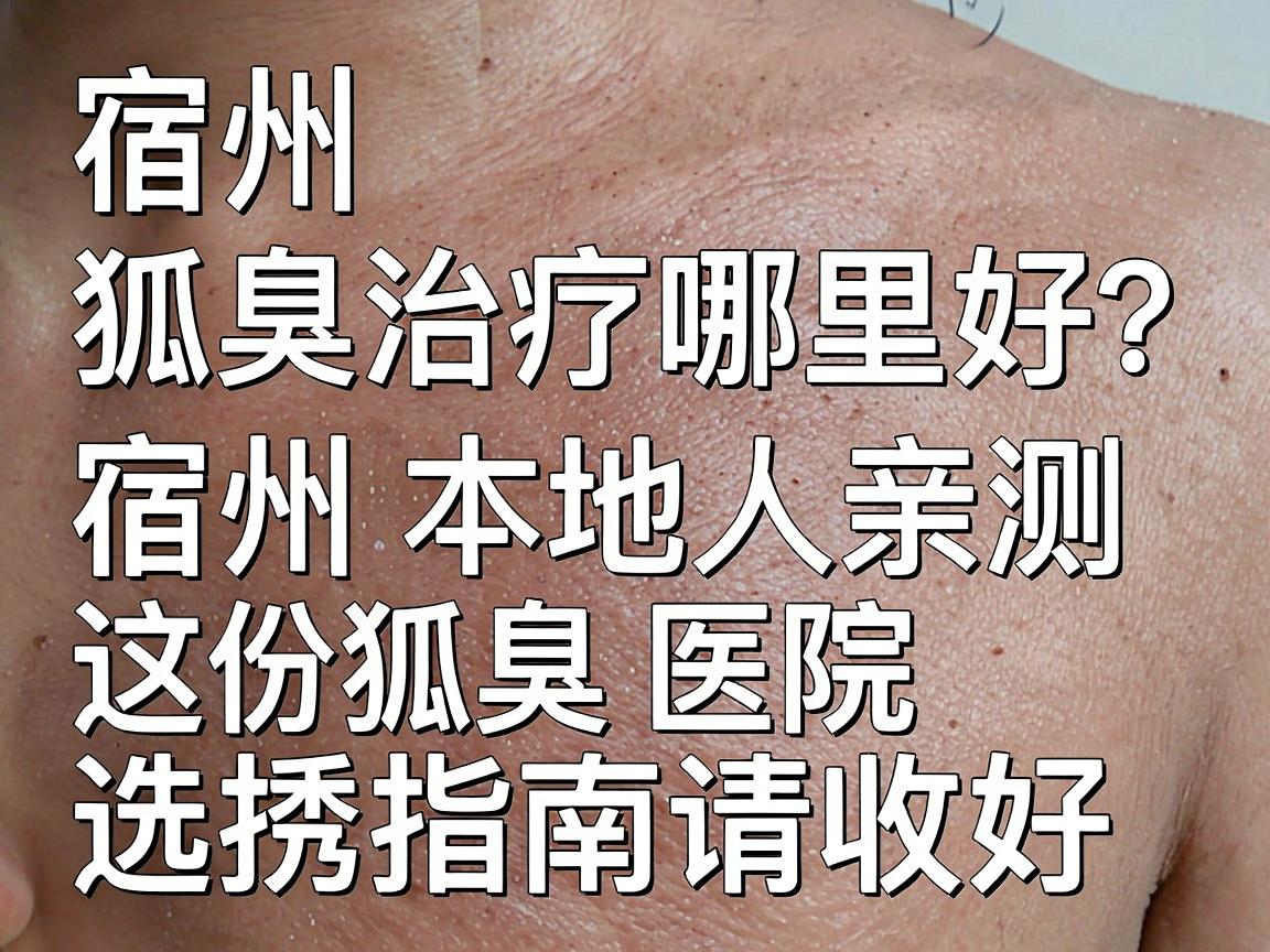 宿州狐臭治疗哪里好？宿州本地人亲测，这份狐臭医院选择指南请收好