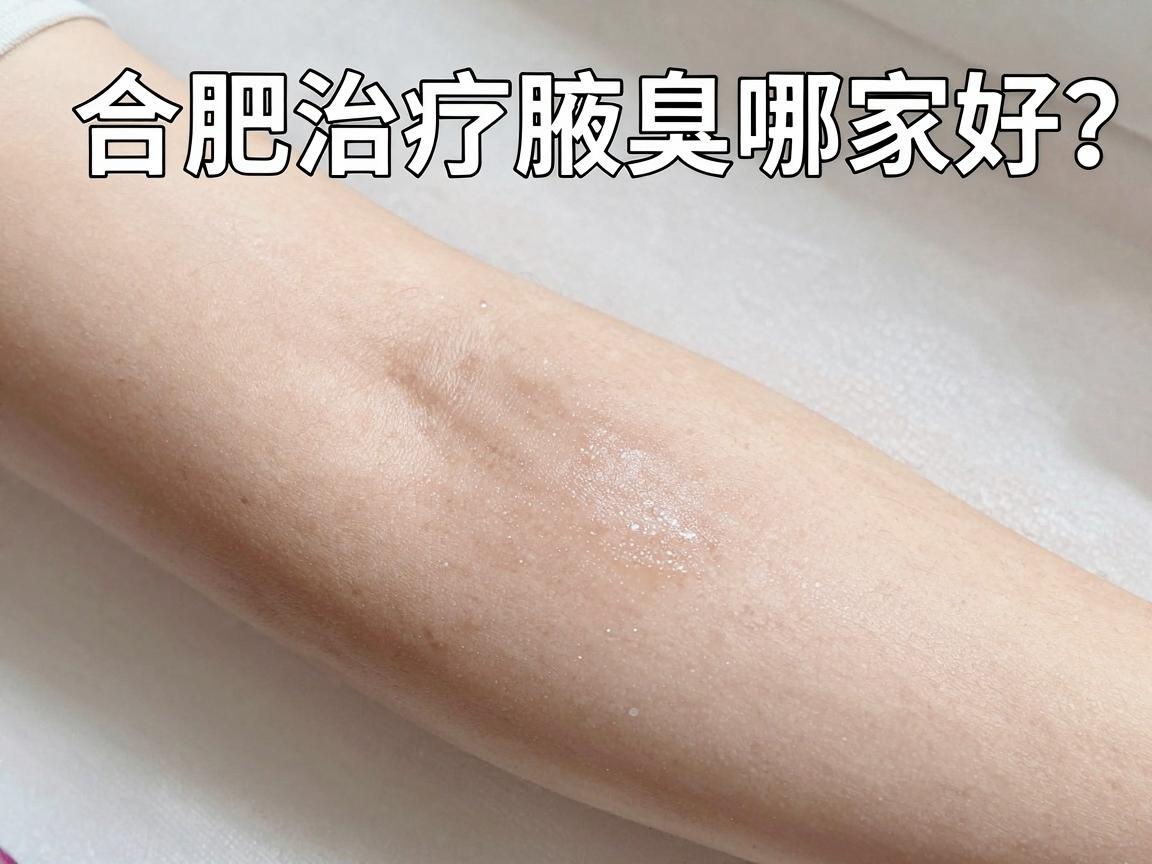 合肥治疗腋臭哪家好？合肥腋秀腋臭专科医院为何成为腋臭患者的优选？