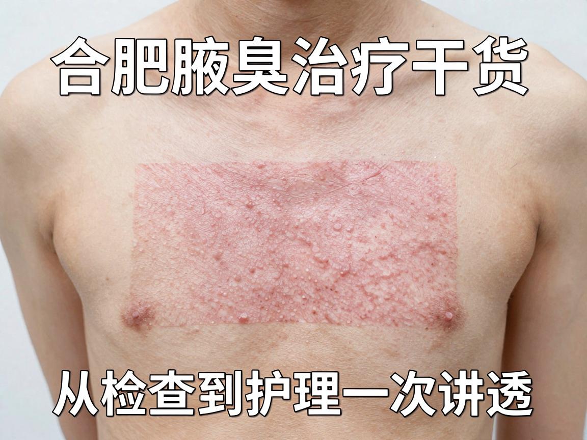 合肥腋臭治疗医院怎么选？合肥腋臭治疗干货，从检查到护理一次讲透