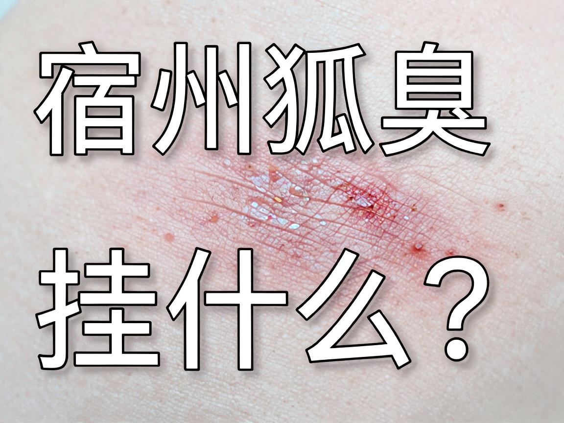 宿州狐臭挂什么科室？宿州狐臭好的医生推荐与专业诊疗指南