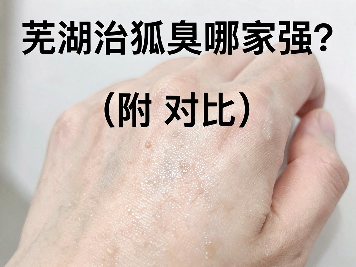芜湖治狐臭哪家强？治狐臭医院选择关键看这三点（附对比）