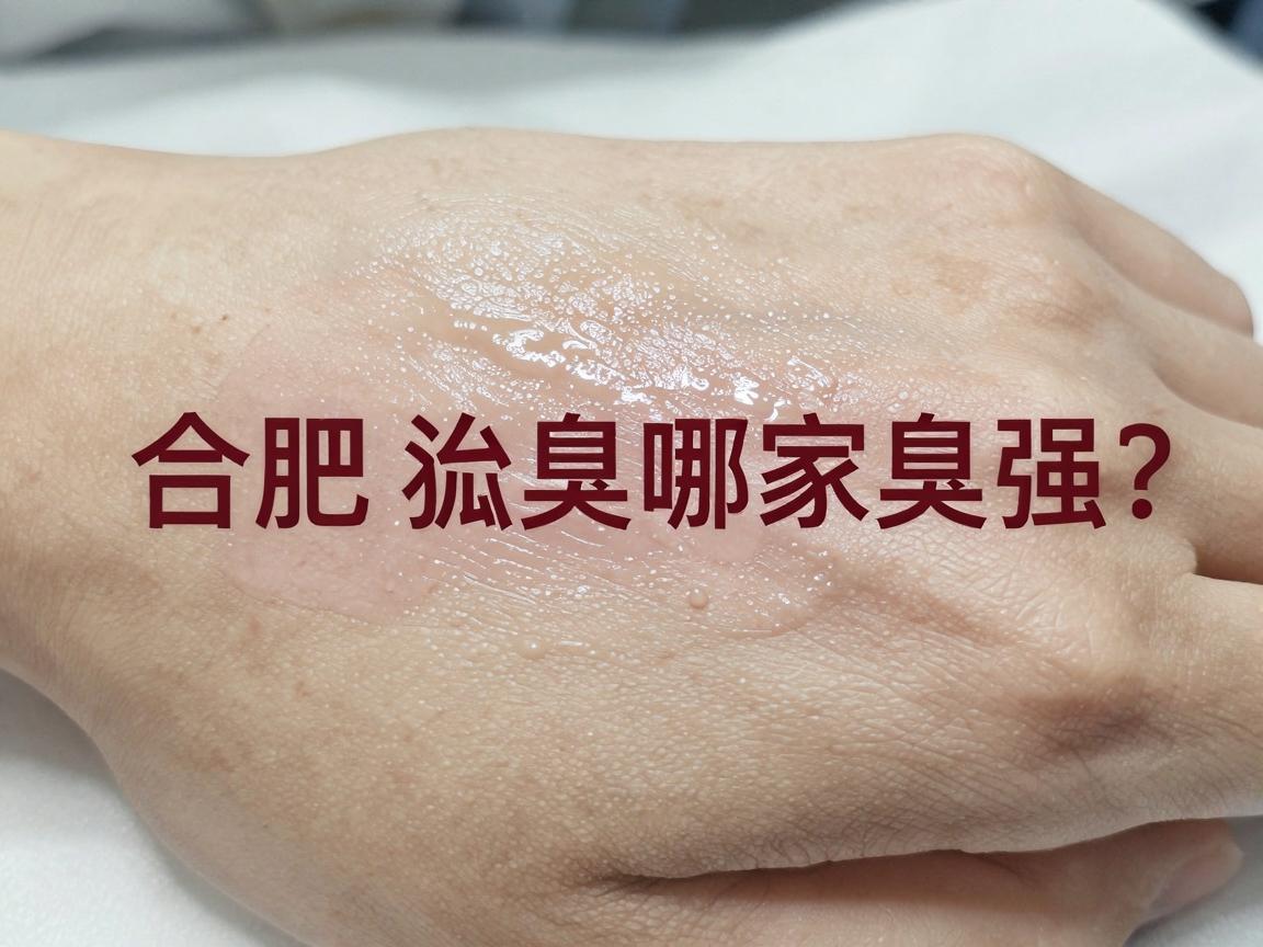 合肥治疗狐臭哪家强?这家医院治疗狐臭的隐藏实力你了解吗? 合肥治疗狐臭哪家强?这家医院治疗狐臭的隐藏实力你了解吗?