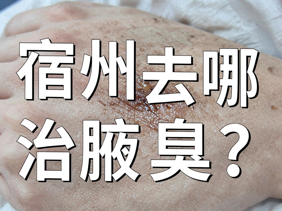 宿州去哪治腋臭？从宿州医院选择到腋臭根治的终极指南