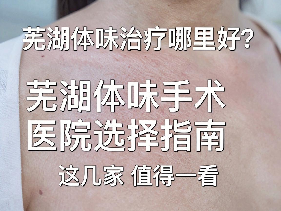 芜湖体味治疗哪里好？芜湖体味手术医院选择指南，这几家值得一看