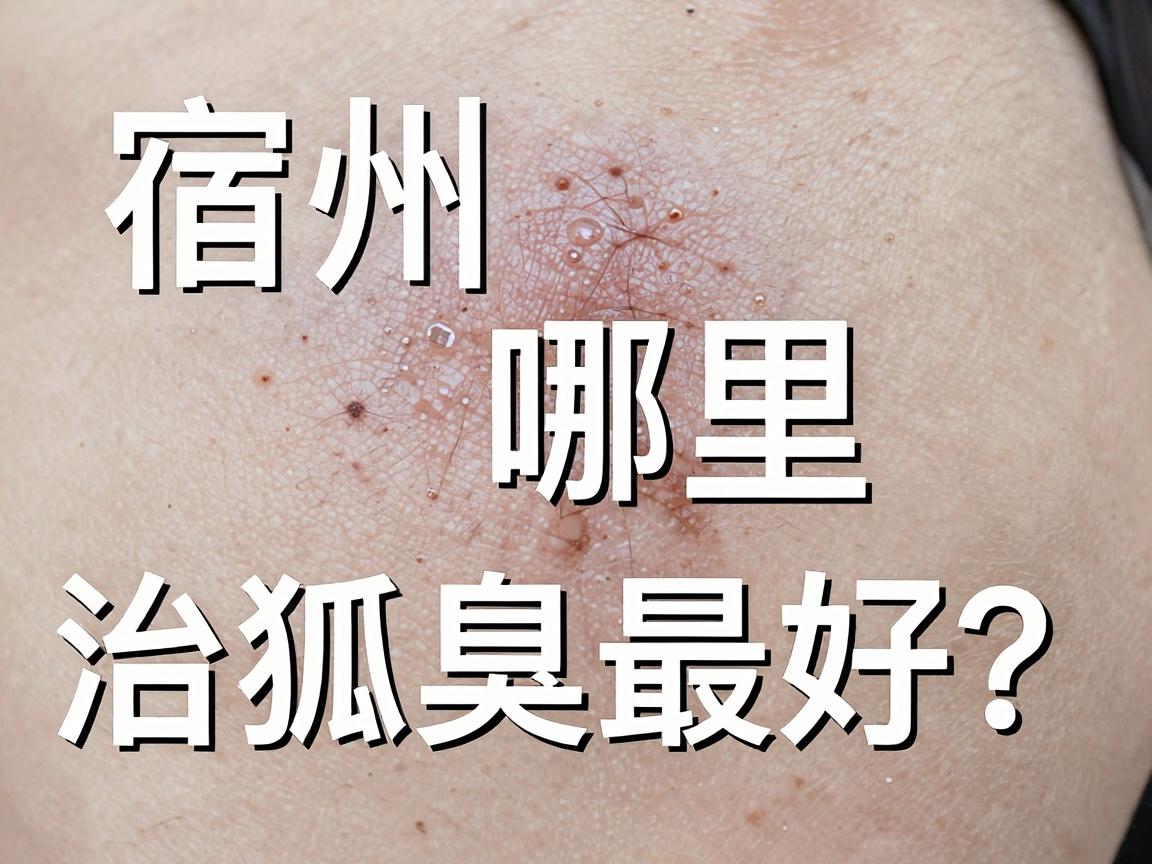 宿州哪里治狐臭最好？资深博主带你扒一扒宿州狐臭治疗的门道