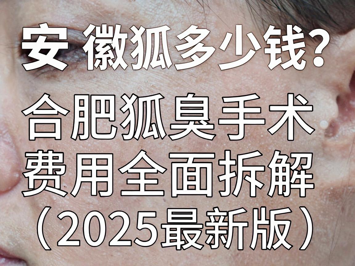 安徽狐臭手术多少钱？合肥狐臭手术费用全面拆解（2025最新版）