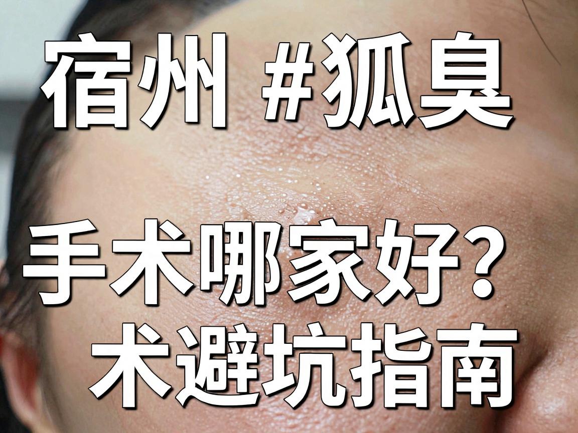 宿州狐臭手术哪家好？别急着选，先看这份宿州腋臭手术避坑指南