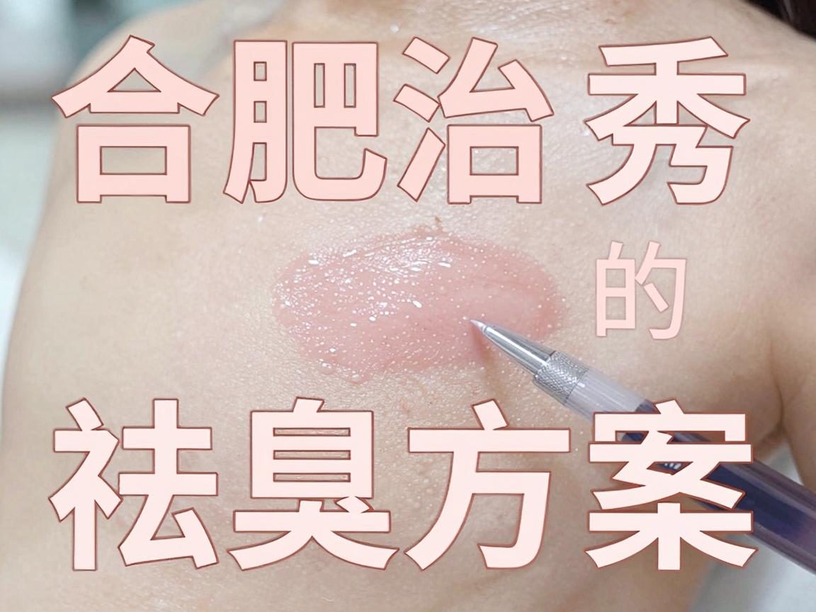 合肥治疗狐臭选哪家医院？合肥腋秀的祛臭方案深度拆解