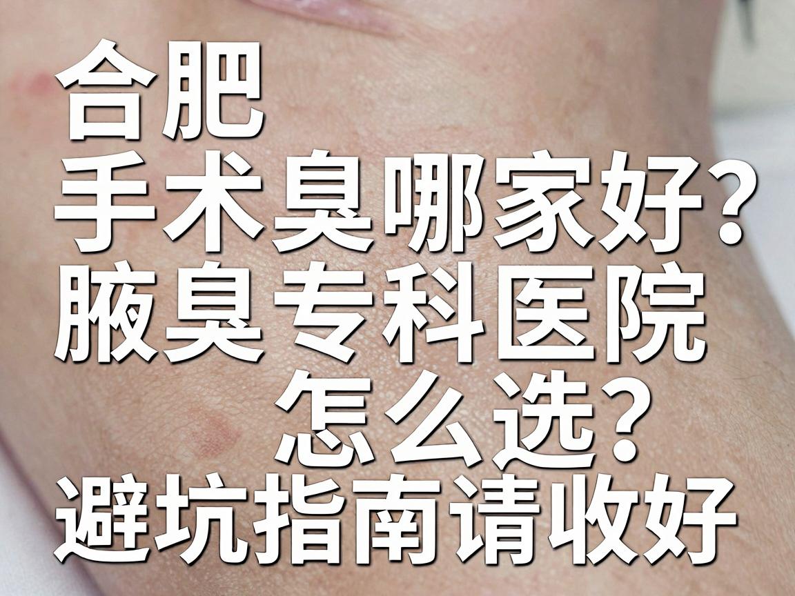 合肥腋臭手术哪家好？腋臭专科医院怎么选？这份避坑指南请收好