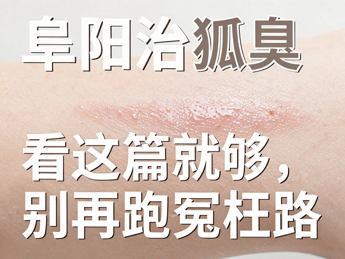 阜阳治狐臭医院怎么选?阜阳治狐臭看这篇就够,别再跑冤枉路 阜阳治狐臭医院怎么选?阜阳治狐臭看这篇就够,别再跑冤枉路