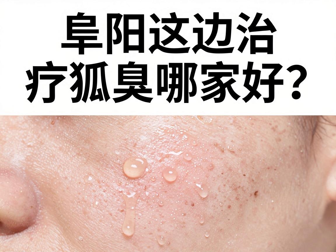 阜阳这边治疗狐臭哪家好？别急着选，先看这3个硬指标评估狐臭治疗好与坏