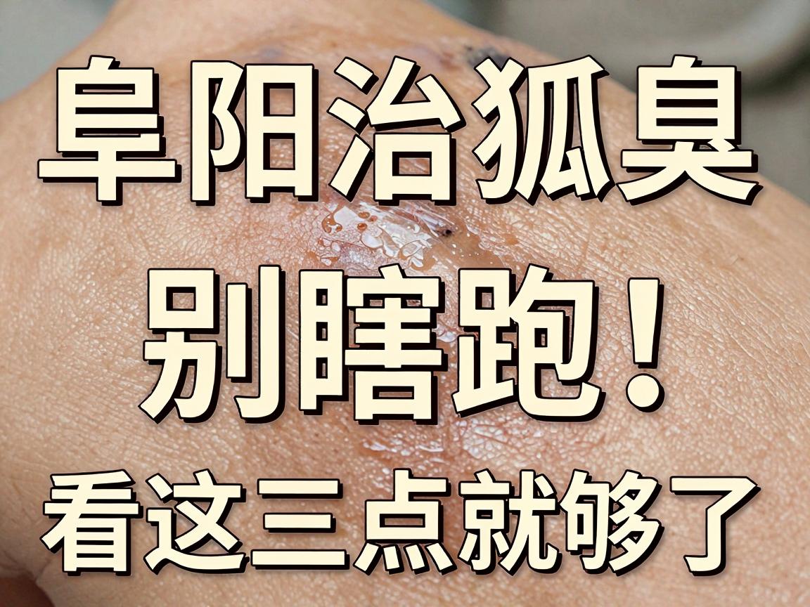 阜阳治狐臭，别瞎跑！阜阳狐臭医院怎么选，看这三点就够了