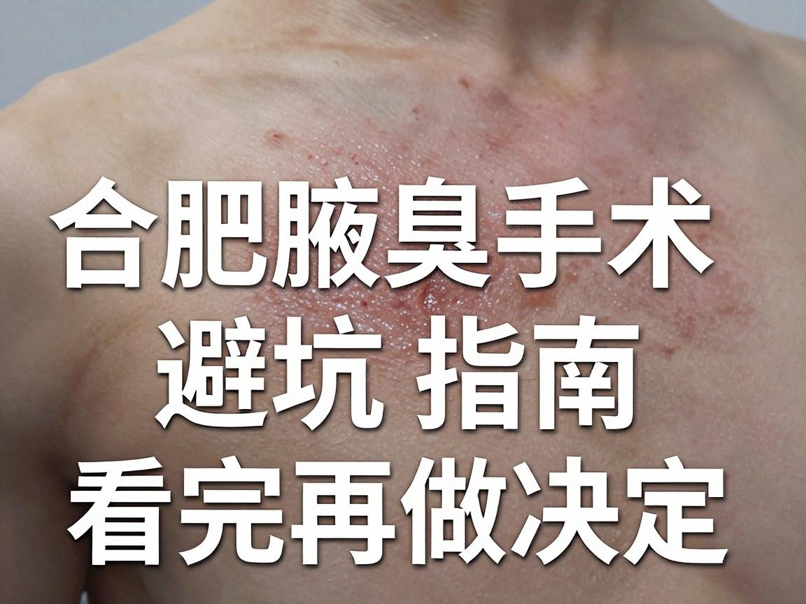 合肥腋臭手术怎么选？合肥腋臭手术避坑指南，看完再做决定