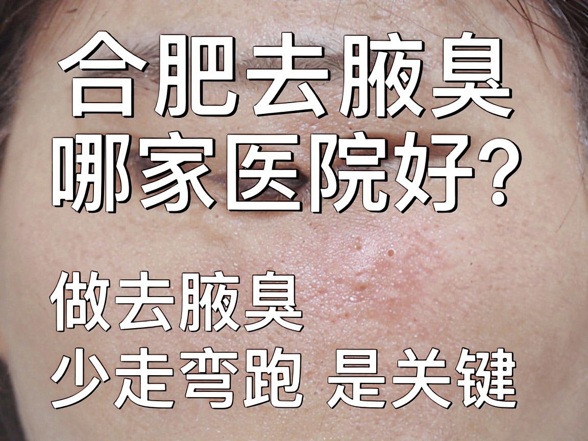 合肥去腋臭哪家医院好？选对医院做去腋臭，少走弯路是关键