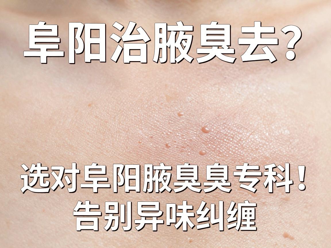 阜阳治腋臭去哪家医院？选对阜阳腋臭专科，告别异味纠缠
