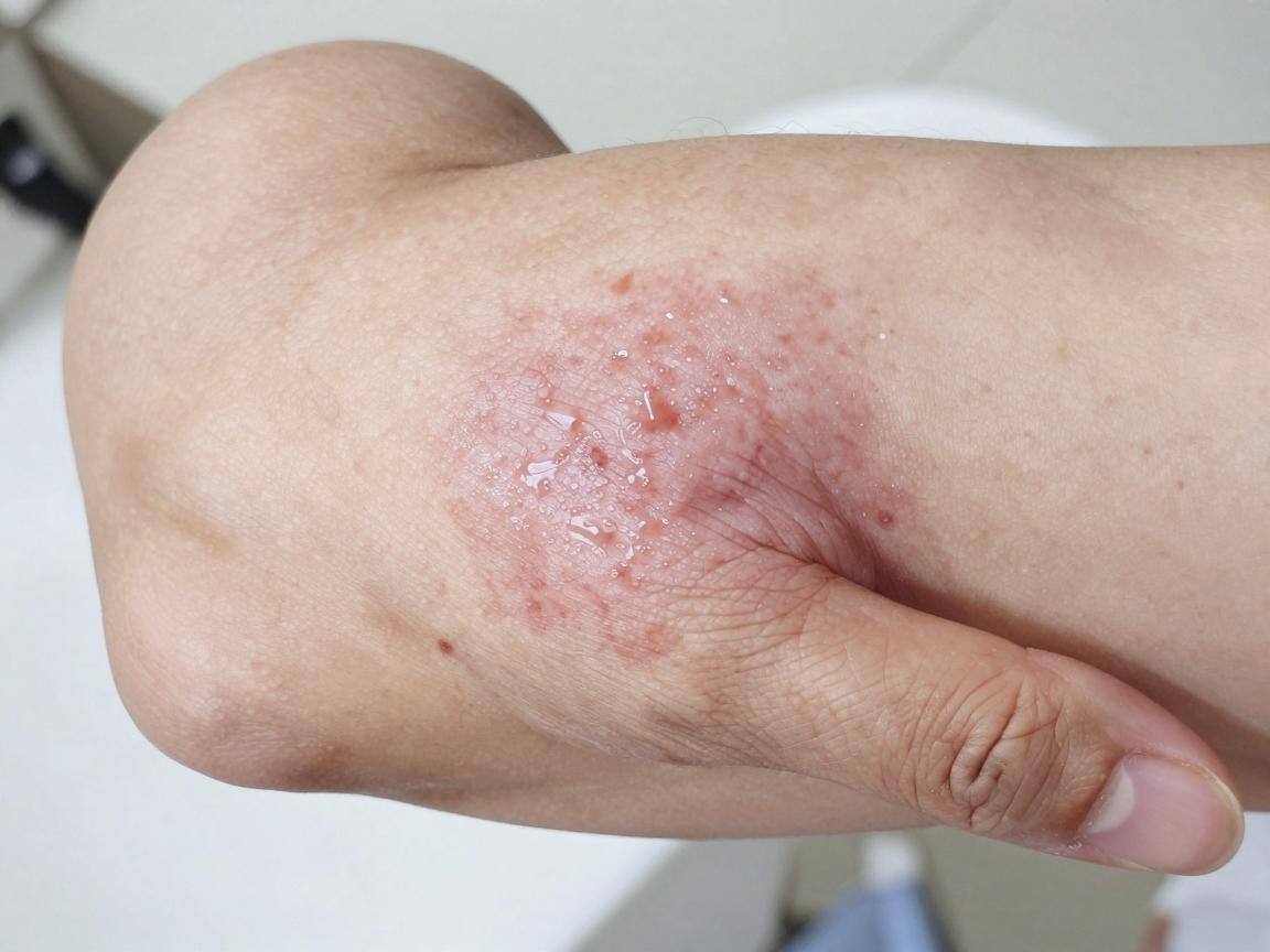 合肥腋秀是私立医院吗？聊聊腋秀医院的性质与看诊体验