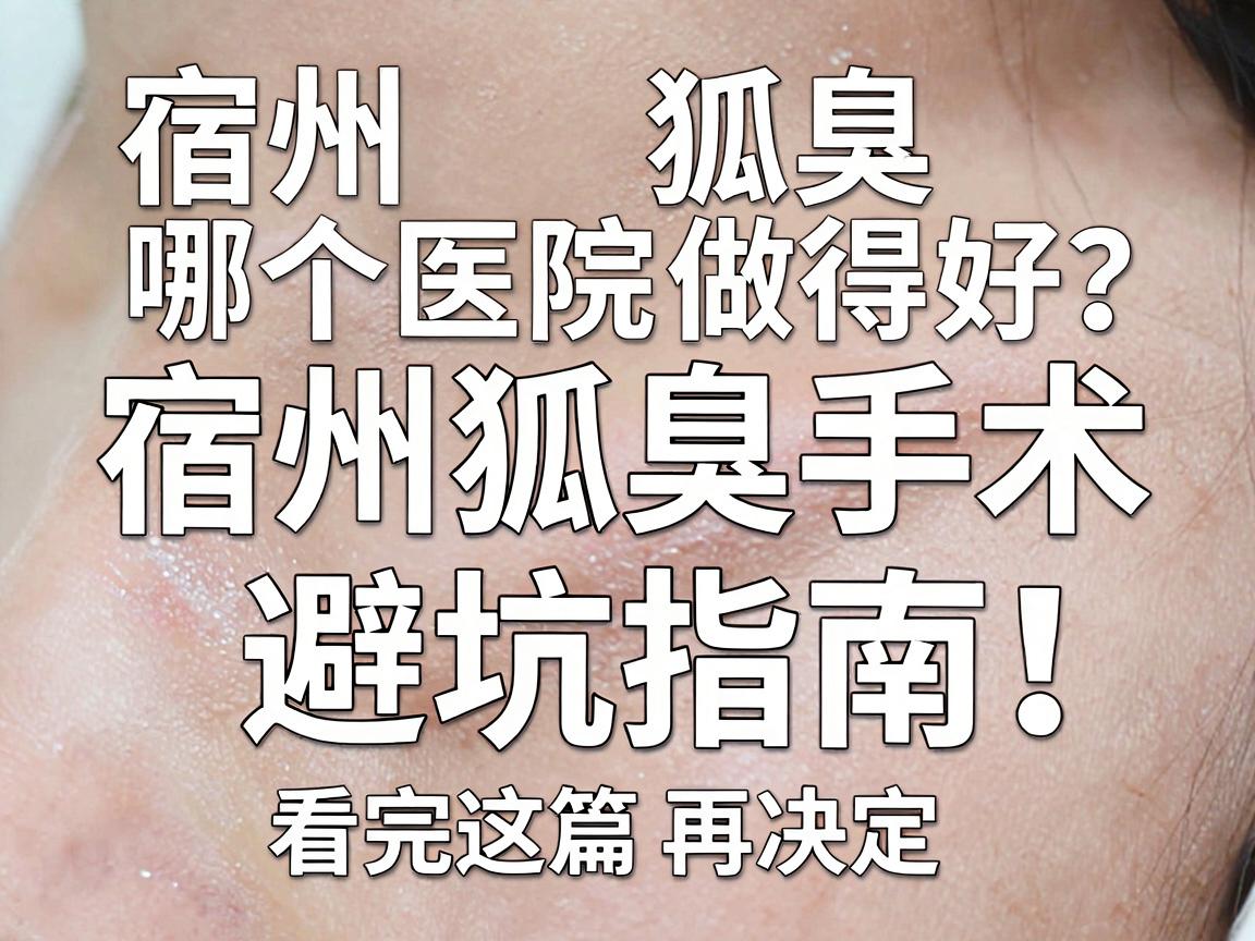 宿州狐臭手术哪个医院做得好？宿州狐臭手术避坑指南，看完这篇再决定